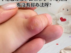 宝宝才两根手指就疼哭了怎么回事【宝宝才两根手指就疼哭了，是怎么回事？】