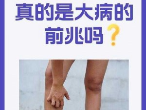 淑芬两腿间又痒又疼是怎么回事？为什么会这样？该怎么办？