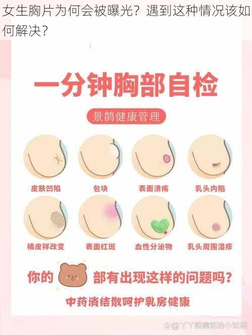 女生胸片为何会被曝光？遇到这种情况该如何解决？